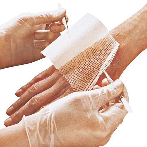 Eine mit parafinbeschichtetet Wundauflage die von einer Person mit weißen Handschuhen und Pinzetten auf die Hand eines Pateinten gelegt wird.jpg